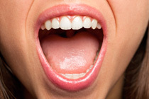 Aftat ja muut suun limakalvovauriot
