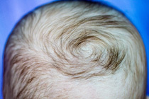 Vauvan hiukset ja päänahka
